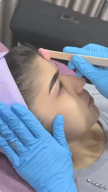 Teen facial waxing forehead-sideburns pink wax @mbrowbar1 1
